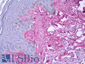 Anti-Collagen V Antibody IHC-plus LS-B7264