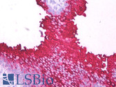 Anti-B3GAT1 Antibody (clone TB01) IHC-plus LS-B7294