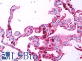Anti-Macrophage Antibody (clone MAC387) IHC-plus LS-B7302