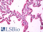 Anti-ALB / Serum Albumin Antibody IHC-plus LS-B7310