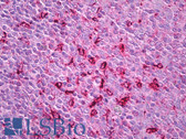 Anti-CTSS / Cathepsin S Antibody IHC-plus LS-B7312