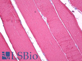 Anti-TNNC1 / Cardiac Troponin C Antibody IHC-plus LS-B7313