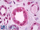 Anti-ZEB2 Antibody (Internal) IHC-plus LS-B7316