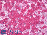 Anti-CFH / Complement Factor H Antibody IHC-plus LS-B7319