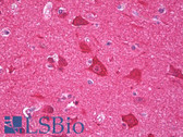 Anti-GCLM Antibody (Internal, clone EPR6668) IHC-plus LS-B7324