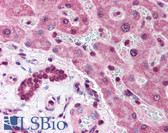 Anti-LRP6 Antibody (aa1546-1560) IHC-plus LS-B140