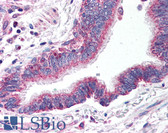 Anti-APOER2 / LRP8 Antibody IHC-plus LS-B141