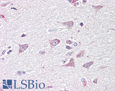 Anti-GOLGA6A Antibody (Internal) IHC-plus LS-B7343