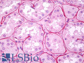 Anti-Collagen IV Antibody IHC-plus LS-B7348