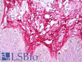 Anti-Collagen III Antibody IHC-plus LS-B7349