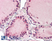 Anti-NAP1 / TAB3 Antibody (aa59-69) IHC-plus LS-B7358