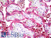 Anti-TGM2 / Transglutaminase 2 Antibody (Internal, clone EP2957) IHC-plus LS-B7375
