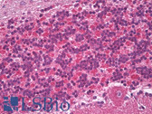 Anti-TLR7 Antibody (Internal) IHC-plus LS-B7376