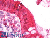 Anti-IDN3 / NIPBL Antibody IHC-plus LS-B7393