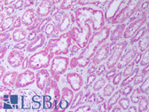 Anti-TNFRSF1B / TNFR2 Antibody IHC-plus LS-B7424