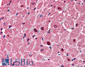 Anti-P2RX6 / P2X6 Antibody (aa66-115) IHC-plus LS-B154