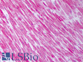 Anti-HSPB1 / HSP27 Antibody (clone 5D12-A12) IHC-plus LS-B7450