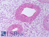 Anti-PDIA3 / ERp57 Antibody (clone Map.ERP57) IHC-plus LS-B7455