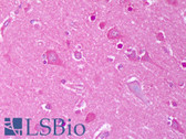 Anti-KCNJ12 / Kir2.2 Antibody (aa362-427, clone S124B-38) IHC-plus LS-B7459