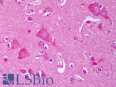 Anti-KCNJ4 / Kir2.3 Antibody (aa390-445, clone S25-35) IHC-plus LS-B7460