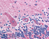 Anti-GABRD Antibody (N-Terminus) IHC-plus LS-B158
