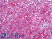 Anti-B2M / Beta 2 Microglobulin Antibody IHC-plus LS-B7493