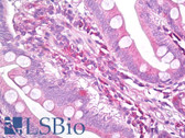 Anti-MCL1 / MCL 1 Antibody (clone Y37) IHC-plus LS-B7496