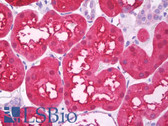Anti-SLC9A3R1 / NHERF1 / EBP50 Antibody (C-Terminus, clone EPR5563) IHC-plus LS-B7499