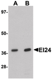 Anti-PIG8 / EI24 Antibody (C-Terminus) IHC-plus LS-B7502