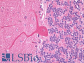 Anti-SLC38A1 / NaT2 Antibody (clone S104-32) IHC-plus LS-B7509