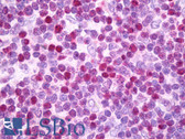 Anti-SATB1 Antibody (Internal, clone EPR3951) IHC-plus LS-B7514