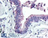 Anti-CLIC4 Antibody (N-Terminus) IHC-plus LS-B161