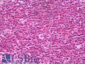 Anti-FOXO1 / FKHR Antibody (aa295-344) IHC-plus LS-B7517