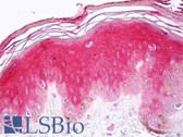 Anti-CASP14 / Caspase 14 Antibody (N-Terminus) IHC-plus LS-B7520