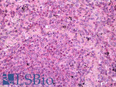 Anti-PADI1 Antibody IHC-plus LS-B7521