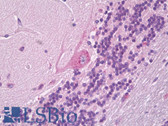 Anti-MTDH / Metadherin Antibody (N-Terminus) IHC-plus LS-B7530