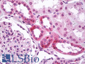Anti-MBD2 Antibody (Internal) IHC-plus LS-B7531