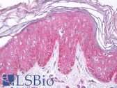 Anti-CFI / Complement Factor I Antibody (Internal) IHC-plus LS-B7532