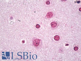 Anti-BACH2 Antibody (Internal) IHC-plus LS-B7533
