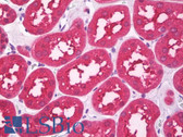 Anti-HTR3B / 5-HT3B Receptor Antibody (Internal) IHC-plus LS-B7535