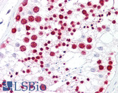 Anti-NPM1 / NPM / Nucleophosmin Antibody (aa201-250) IHC-plus LS-B7552
