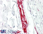 Anti-MEF2A / MEF2 Antibody (aa374-423) IHC-plus LS-B7554