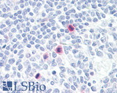 Anti-PLA2G4A Antibody (aa471-520) IHC-plus LS-B7555