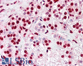 Anti-XRCC6 / Ku70 Antibody (aa1-50) IHC-plus LS-B7560