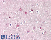 Anti-ADD1 Antibody (aa411-460) IHC-plus LS-B7561