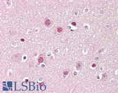Anti-ADD1 Antibody (aa411-460) IHC-plus LS-B7561