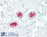 Anti-MAP3K5 / ASK1 Antibody (aa49-98) IHC-plus LS-B7565