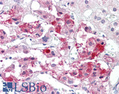 Anti-BAD Antibody (aa119-168) IHC-plus LS-B7566
