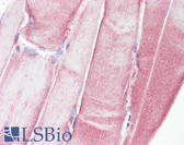 Anti-HSPB1 / HSP27 Antibody (aa45-94) IHC-plus LS-B7570