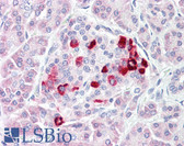 Anti-IGF1R / IGF1 Receptor Antibody (aa1126-1175) IHC-plus LS-B7571